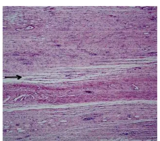FIGURE 18 - Histological view shows perfect adherence of the parietal peritoneum (arrow).