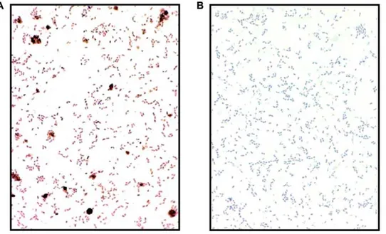 Figure 3. AD brain homogenates have increased antimicrobial activity against C. albicans 
