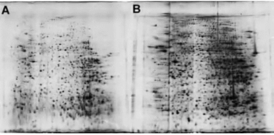 Figure 10-2D-E of rat liver extracts. In A no thiourea was used in the buffer solution, while in B thiourea was used as a  buffer component at 2 Mol/L