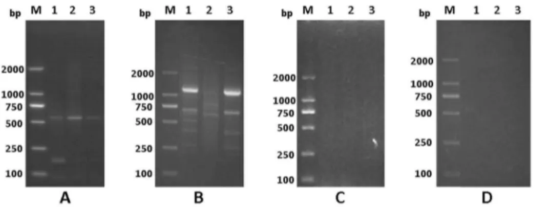 Figure 1. Specificity of APOT assay in detection of HPV16 oncogene transcripts. Amplified products from CaSki cells (A), HPV16-positive CxCa (B), HPV negative normal cervical tissues (C) and the ‘‘minus-RT’’ controls of the RNA isolated from HPV 16-positiv