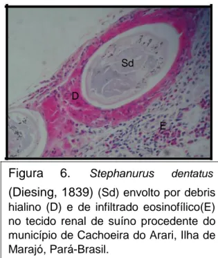 Figura 5. Stephanurus dentatus 