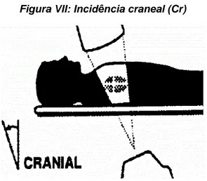 Figura VII: Incidência craneal (Cr)