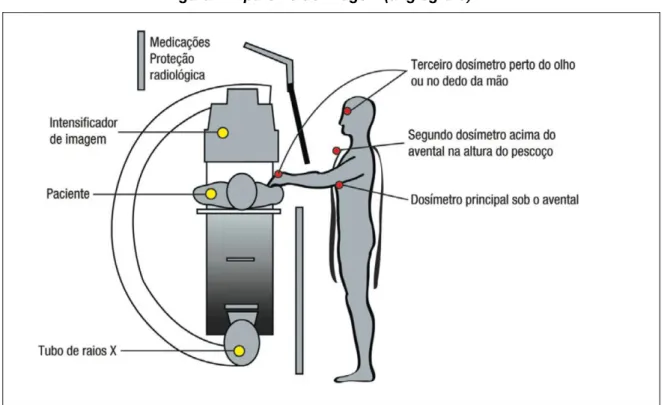 Figura II: Aparelho de Imagem (angiógrafo)