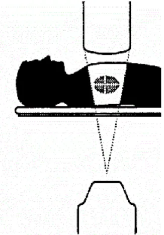 Figura IV: Projeção lateral (PL)