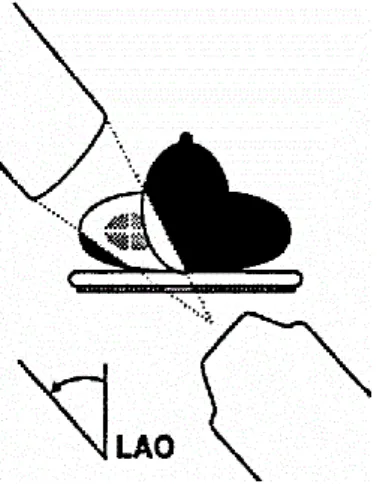Figura V: Incidência oblíqua anterior direita (OAD)