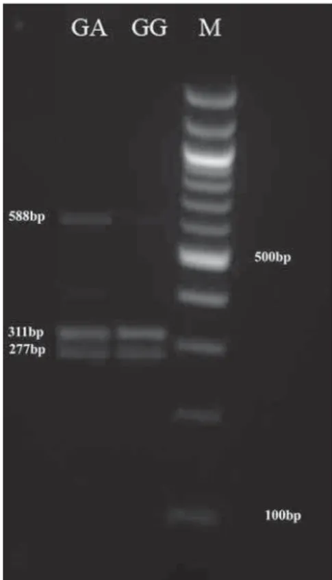 Figu r e - 1 : Polym erase chain react ion- rest rict ion fragm ent   lengt h polym orphism s of m annose- binding lect ins gene  fragm ent  using ApaI  RE