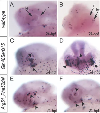 Fig 5. Summary of TUNEL assays in zebrafish wild-type and mab21l2 mutant embryos. TUNEL results in 24-hpf wild-type (A-B), mab21l2 Q48Sfs*5 embryos (C-D) and mab21l2 R51_F52del mutants (E-F) are shown.