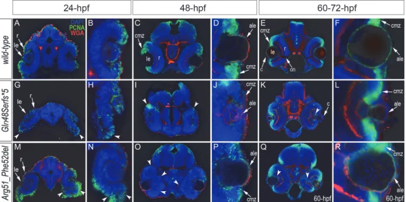 Fig 6. Analysis of proliferation patterns and differentiation markers in wild-type and mutant embryos