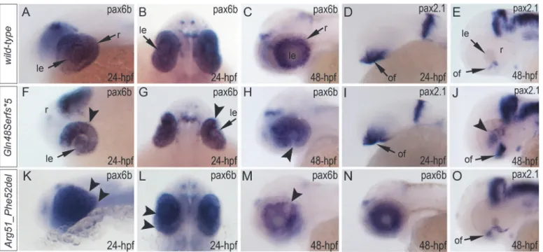 Fig 7. Analysis of pax6b, pax2.1 and foxe3 expression in wild-type, mab21l2 Q48Sfs * 5 and mab21l2 R51_F52del embryos