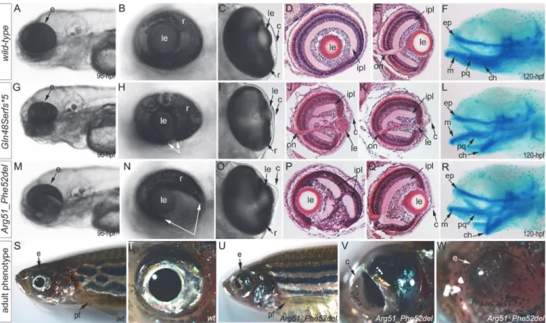 Fig 4. Phenotypic analysis of homozygous embryos carrying mutant mab21l2 alleles encoding p.(Gln48Serfs * 5) truncation (mab21l2 Q48Sfs*5 ) and p.(Arg51_Phe52del) in-frame deletion (mab21l2 R51_F52del ) proteins