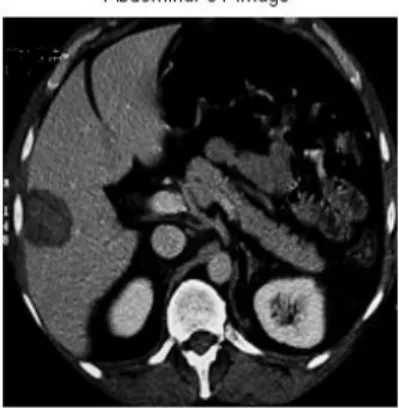 Figure 2.   Plot showing liver intensity 