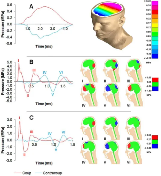 Figure 2. Intra-cranial pressure-time histories and distributions. Pressure-time histories at the coup (red lines) and contre-coup (blue lines) for impacts with different mass projectiles, and contour plots captured at different instants in each case