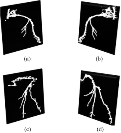 Fig. 8:  Four  3D  shapes  of  different  angiograms  from  different angles 
