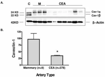 Figure 1. Cav-1 expression pattern in normal and atheroscle- atheroscle-rotic lesions