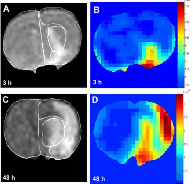 Figure 1. Representative DWI (A and C) and corresponding permeability maps (B and D) of coronal sections of rat brains