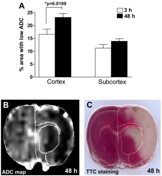 Figure 3. A. Changes in the area with hypointensive ADC at 3 and 48 h of reperfusion. Significant increases in areas with ADC abnormalities were found between 3 and 48 h in the cerebral cortex