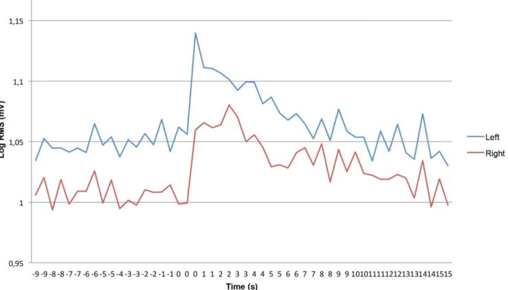 Figure 2. Direct stimulus response, showing a time interval of 10 seconds pre-stimulus to 15 seconds post-stimulus.