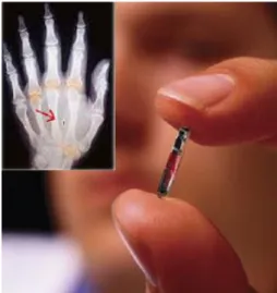 Figura 18 - Implante RFID - Seriot (2005)