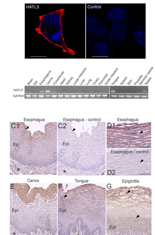 Figure 4. HATL5 expression and localization. (A) Micrographs of fluorescent confocal analysis showing cell surface expression in representative examples of HEK293 cells transiently transfected with a human full-length HATL5-V5 expression plasmid