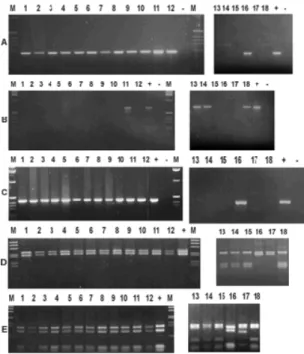 Figure 1: Agarose gel stained with ethidium bromide showing results of amplification of fragments DT6 (A), DT1 (B), IS1245 (C) and hsp65 digested with BstEII (D) and HaeIII (E)