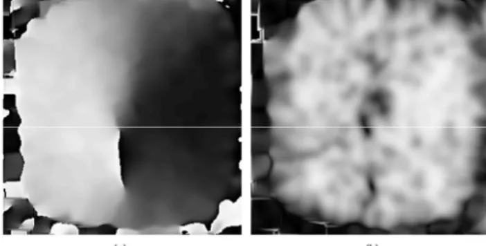 Figure 9. Gray-scale coded directional field and coherence. (a) Directional field and (b) coherence.