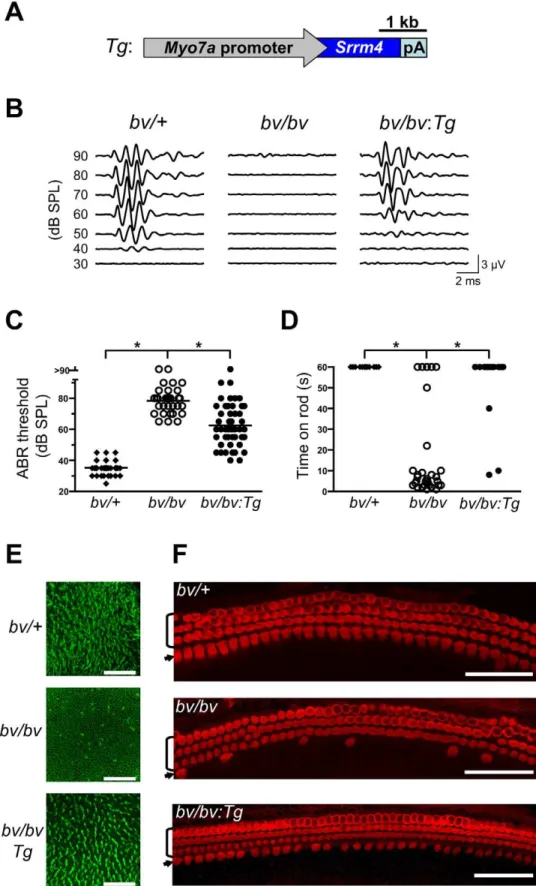 Figure 3. The bv phenotype is rescued by hair-cell targeted expression of an Srrm4 transgene