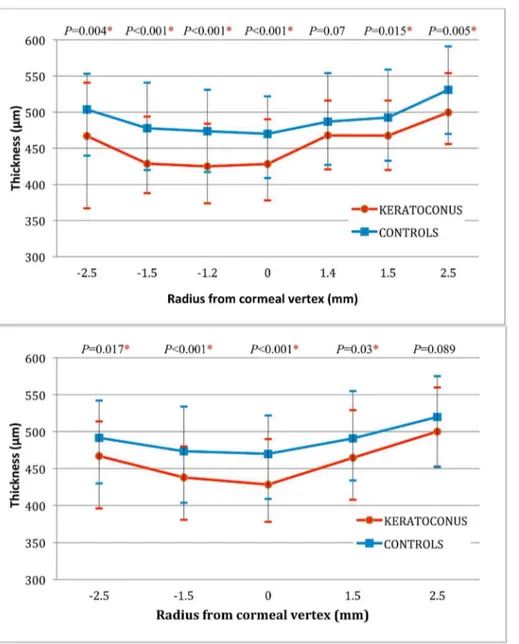 Figure 4. Comparison of average stromal thicknesses for keratoconic and healthy astigmatic eyes