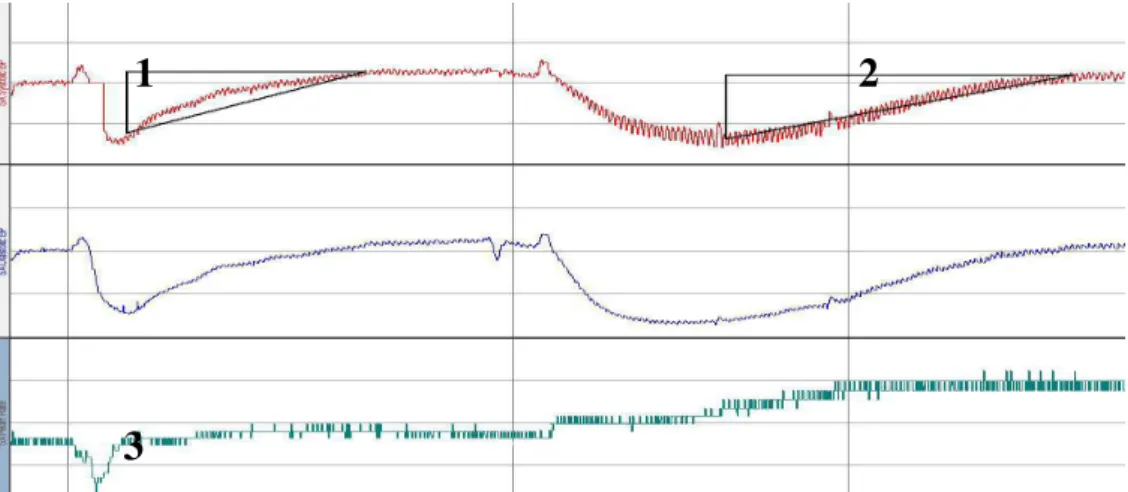Figure 1. The dynamics of systolic and diastolic blood pressure and heart rate during the functional vascular trial  with intravenous solutions of acetylcholine and sodium nitroprusside