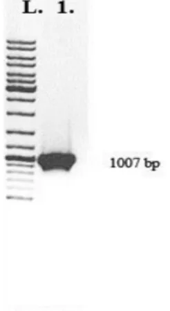 Figure 1. Electrophoresis of DNA fragment after PCR amplification on 1% agarose gel. L
