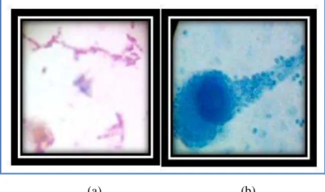 Figure 3 Clear zone formation around the colony in polythene powder incorporated media (a-f)