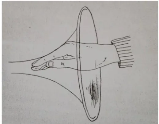 Figura nº 2 – Posicionamento da mão na campânula 