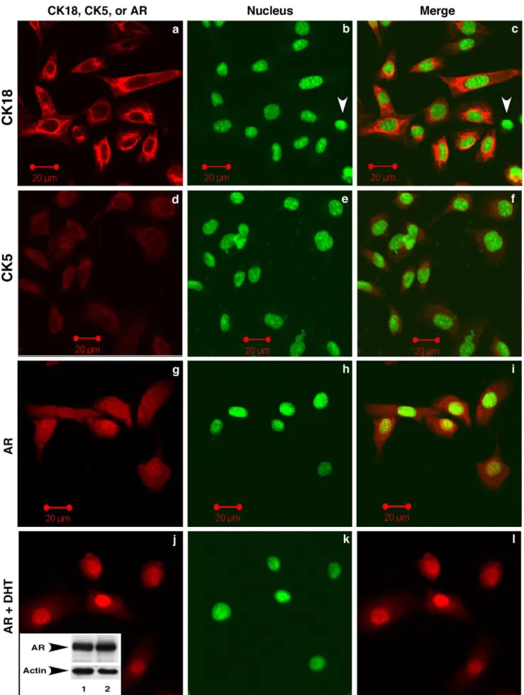 Figure 7. Temperature-sensitive large T antigen-immortalized prostate epithelial cells (LTA ts -ECs) express markers of prostate epithelial cells