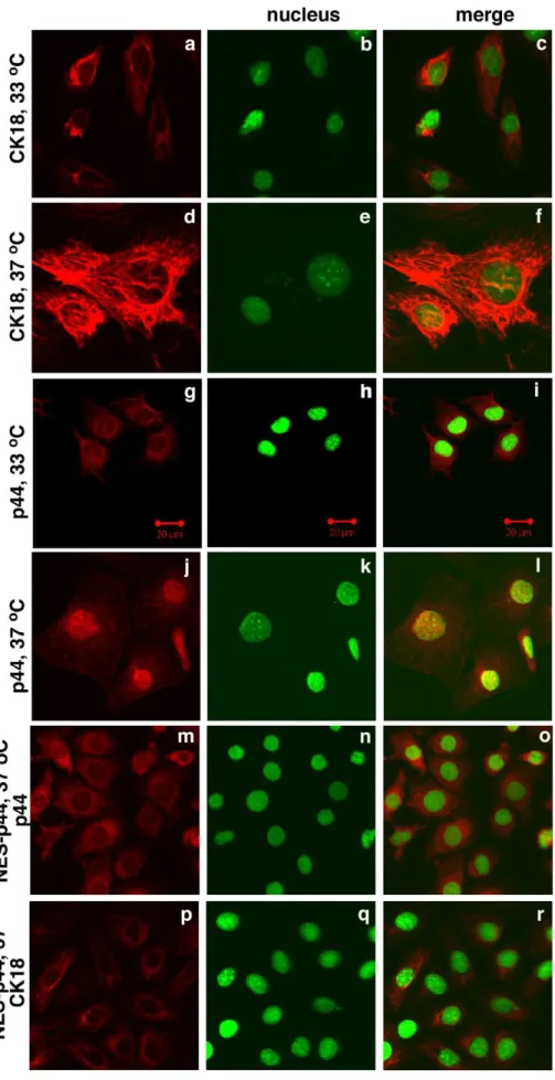 Figure 8. Cytoplasmic p44 inhibited the temperature-dependent differentiation of prostate epithelial cells