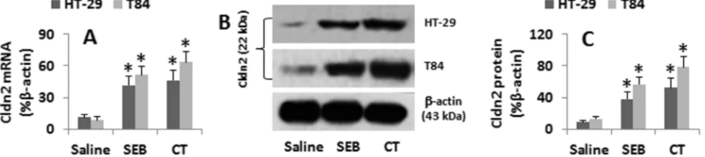 Figure 3. Assessment of gut epithelial monolayer barrier function. Confluent HT-29 monolayers were exposed to SEB or CT (500 ng/ml) in the culture