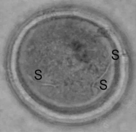 Gambar 10. Polispermi. Keterangan: S = Spermatozoa 