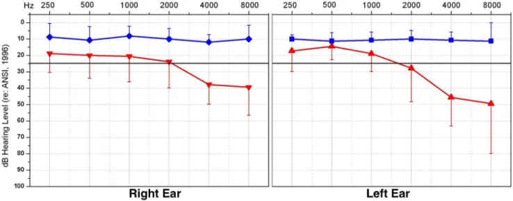 Figure 1. Mean audiometric subject thresholds. Auditory thresholds are shown for right and left ears for the standard audiometric frequencies from 250 Hz to 8000 Hz