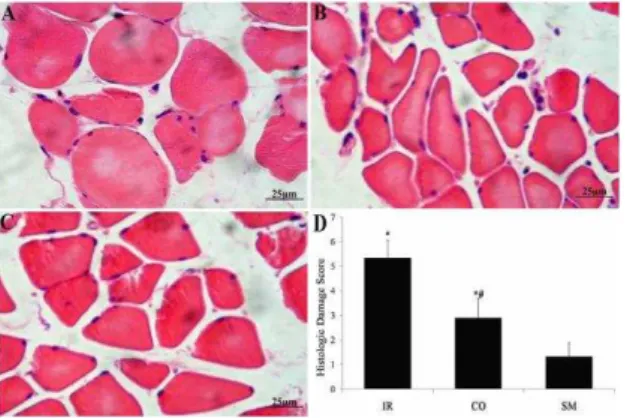 Figure  2.  The  degrees  of  muscle  edema  in  the  IR  group,  colchicine  treated-IR  (CO)  group  and  sham  operation  (SM)  group