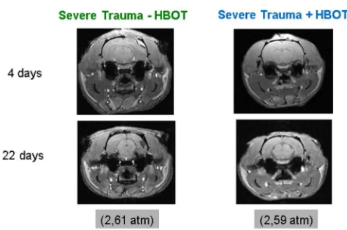 Figure 2. Representative coronal sections through a rat brain from the T1-weighted gradient echo sequence at days 4 and 22 following trauma and repetitive HBO treatment