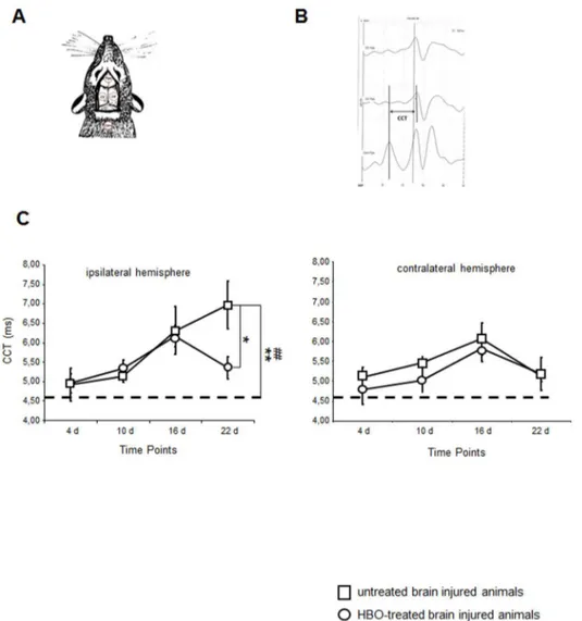 Figure 3. Time-dependent changes in the central conduction times following traumatic brain injury and HBO treatment established by somatosensory-evoked potentials