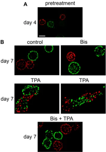Figure 10. TPA stimulates cells to move into neighboring acini.