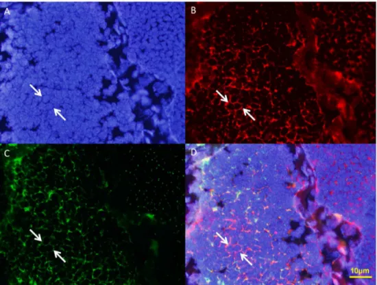 Figure 13. Immunofluorescent localization of KIF3A and tubulin in the early stage during spermiogenesis in E