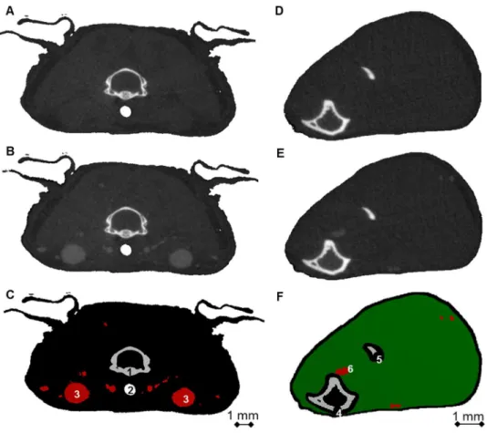 Figure 1. Cross-sections used in the calculation of vascular density. Representative cross-sections of the reference region (neck, A–C) and the region of interest (right lower hind limb, D–F)