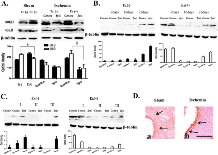 Figure 2. NT-4 expression profile. (A) Two forms, dimer (80 kDa) and monomer (40–47 kDa), were detected