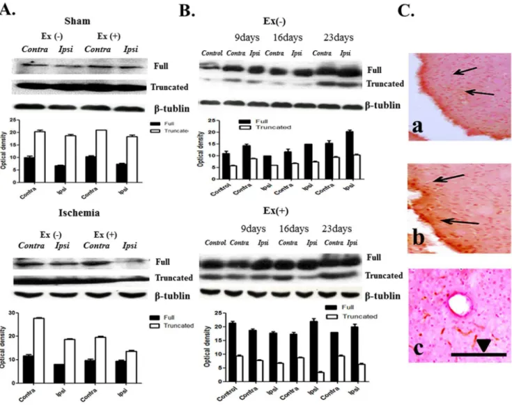 Figure 3. TrkB expression. (A) Two forms of trkB are noted: full length form (140 kDa) and truncated form (90,95 kDa)