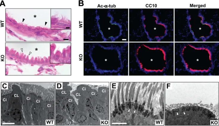 Figure 7. Proximal airway phenotypes of Cby 2/2 mice. (A) Lung airway sections from adult Cby +/+ and Cby 2/2 mice were stained with H&amp;E.