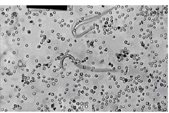 Fig. 1: Microfilariae  in  the  bloodstream  of  nine-banded  armadillos 