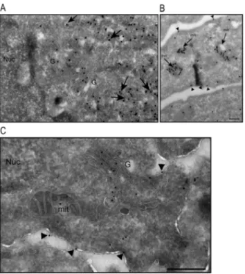 Fig. 3. Analysis of MAP6d1 localization by electron microscopy. A–B, NIH/3T3 cells were transfected with a MAP6d1-myc encoding plasmid and analyzed by electron microscopy