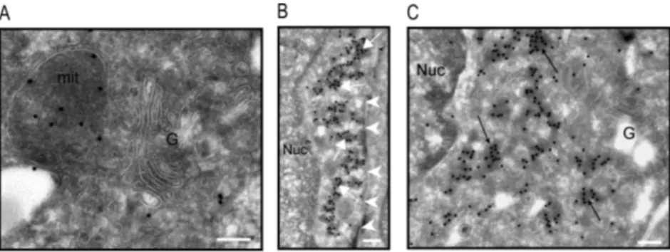 Fig. 5. Analysis of MAP6d1-GGG localization by electron microscopy. A–C, NIH/3T3 cells were transfected with a plasmid encoding MAP6d1-GGG-myc and immuno-gold labeled
