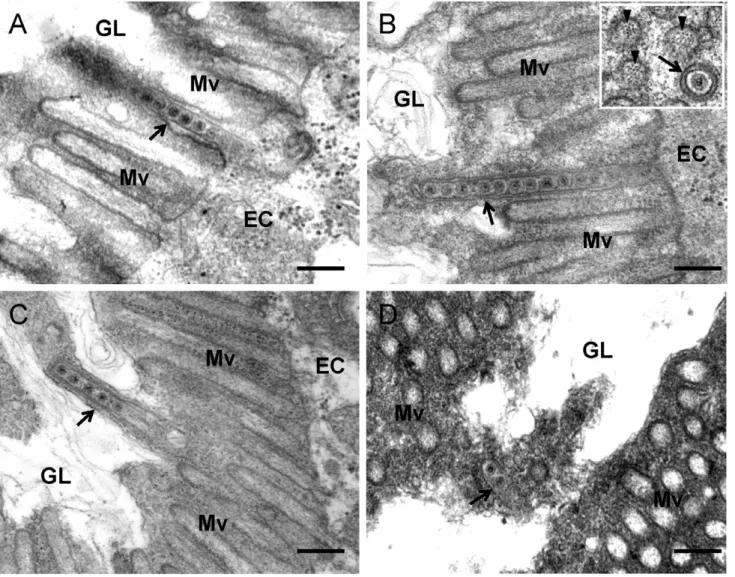 Figure 5. Transmission electron micrographs showing the association of virus-containing tubules with microvilli of anterior midgut in viruliferous leafhoppers