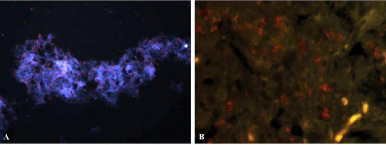 Figure 2. FISH detecting Mtb in culture and mouse lung tissue. Mtb (red) was detected in (A) hypoxic culture and (B) GKO mouse lung tissue at 4 weeks post infection